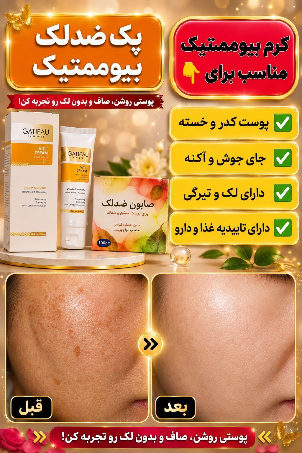 کرم بیوممتیک