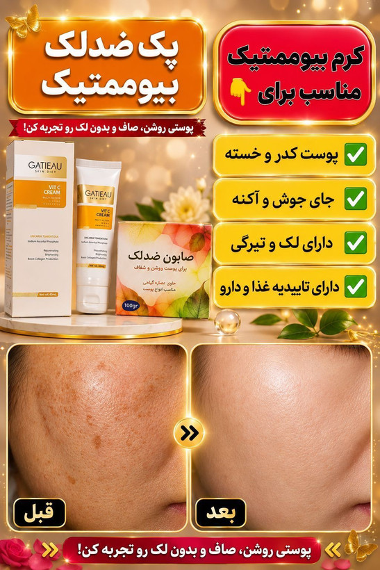 کرم بیوممتیک